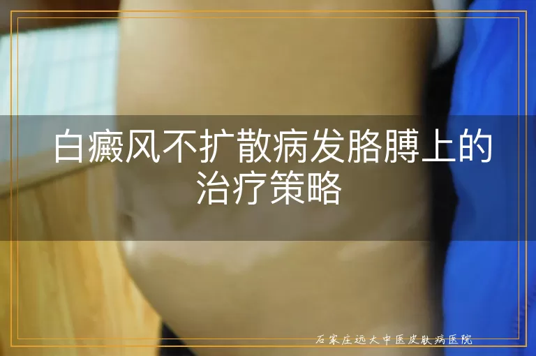 白癜风不扩散病发胳膊上的治疗策略