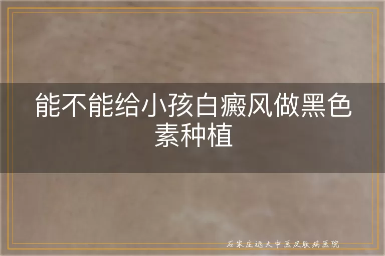 能不能给小孩白癜风做黑色素种植