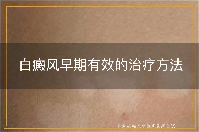 白癜风早期有效的治疗方法