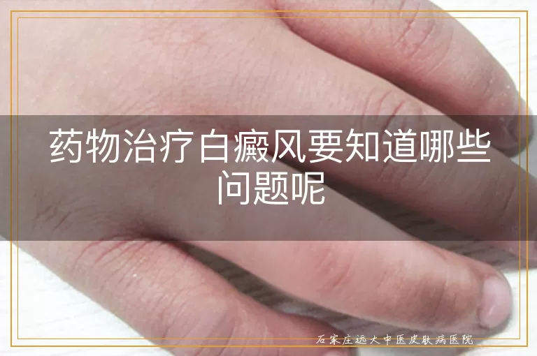 药物治疗白癜风要知道哪些问题呢