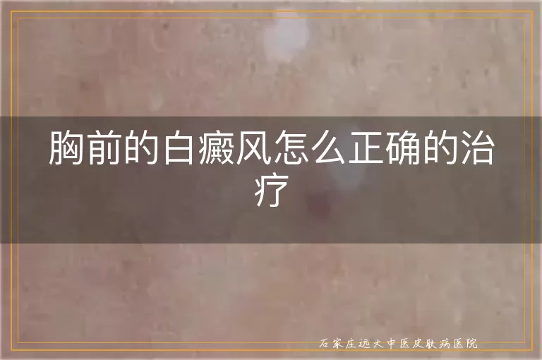 胸前的白癜风怎么正确的治疗