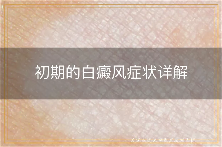 初期的白癜风症状详解