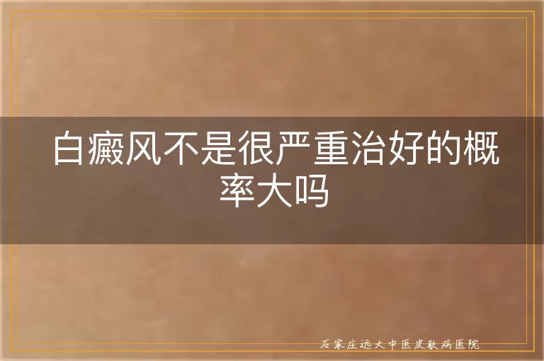 白癜风不是很严重治好的概率大吗