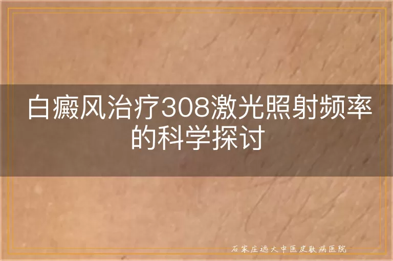 白癜风治疗308激光照射频率的科学探讨