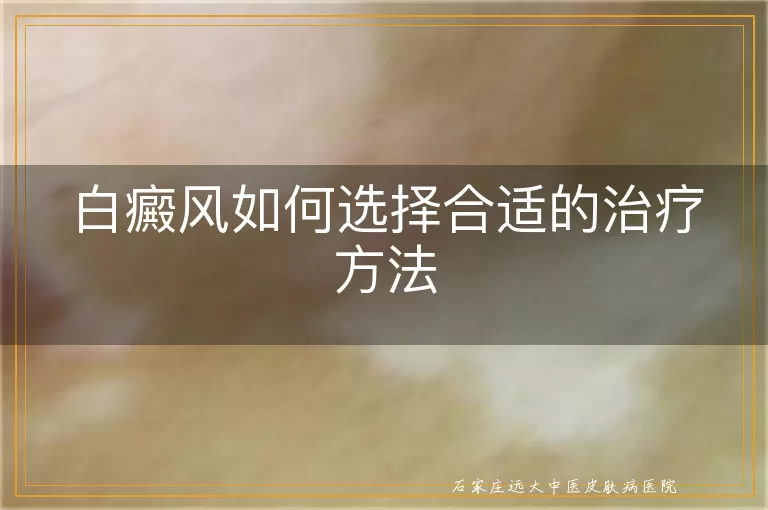 白癜风如何选择合适的治疗方法