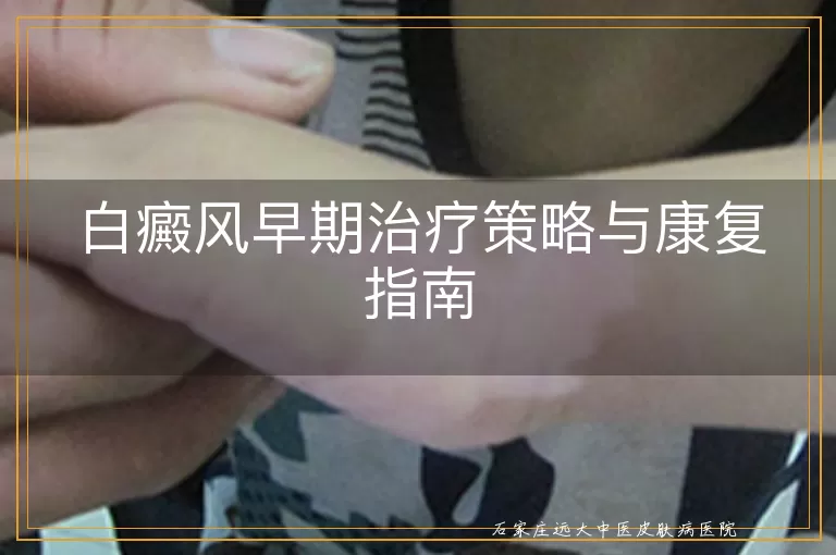 白癜风早期治疗策略与康复指南