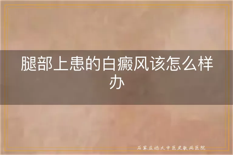 腿部上患的白癜风该怎么样办