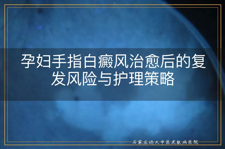 孕妇手指白癜风治愈后的复发风险与护理策略