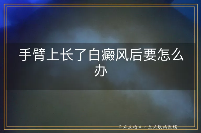 手臂上长了白癜风后要怎么办