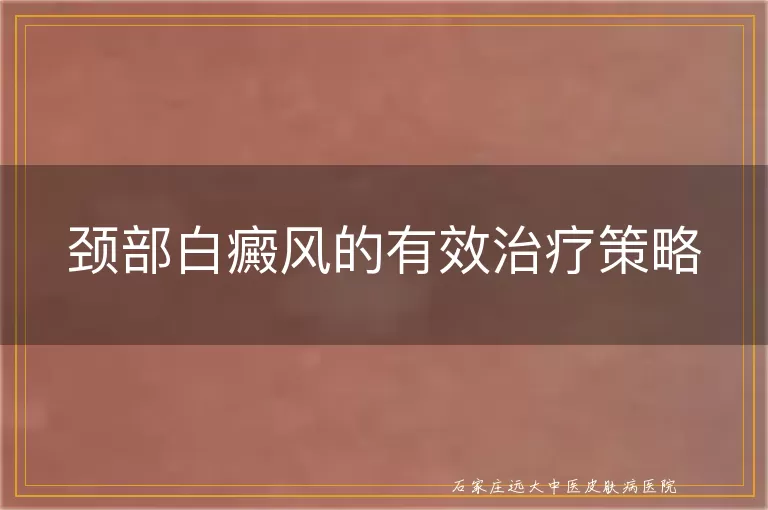 颈部白癜风的有效治疗策略