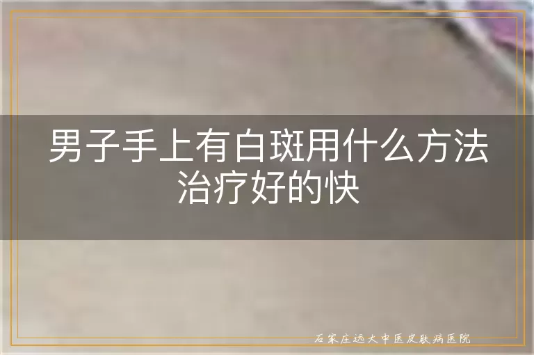 男子手上有白斑用什么方法治疗好的快