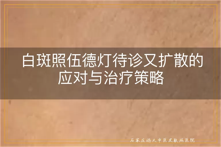 白斑照伍德灯待诊又扩散的应对与治疗策略