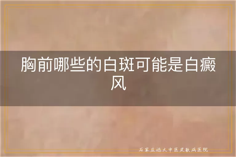 胸前哪些的白斑可能是白癜风