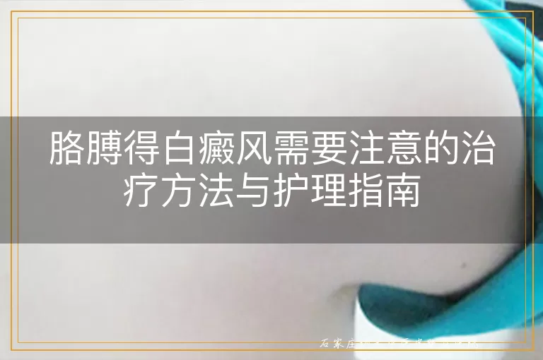 胳膊得白癜风需要注意的治疗方法与护理指南