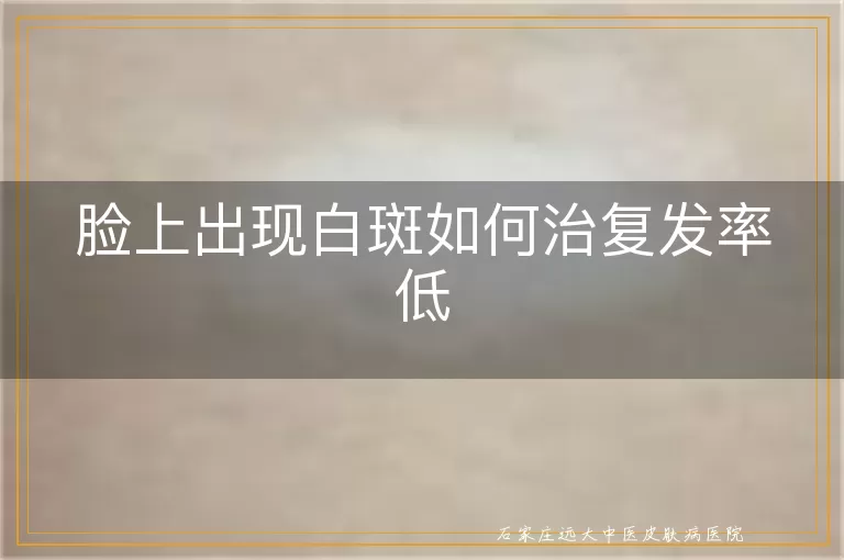 脸上出现白斑如何治复发率低