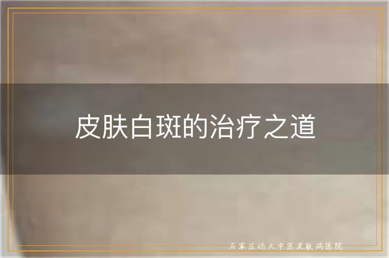 皮肤白斑的治疗之道