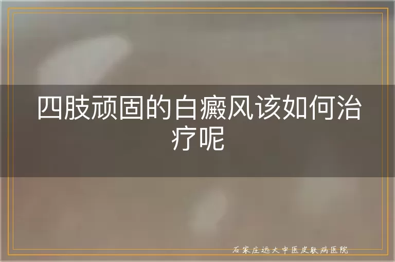 四肢顽固的白癜风该如何治疗呢