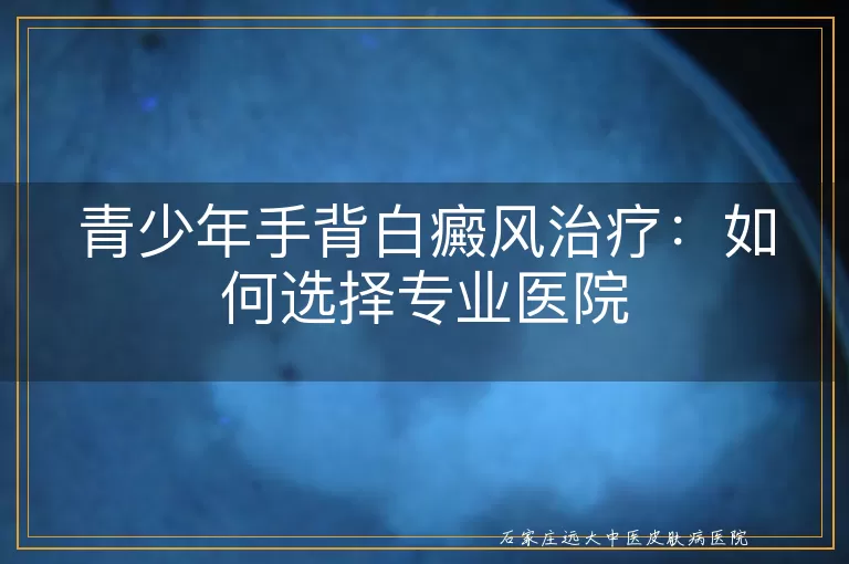 青少年手背白癜风治疗：如何选择专业医院