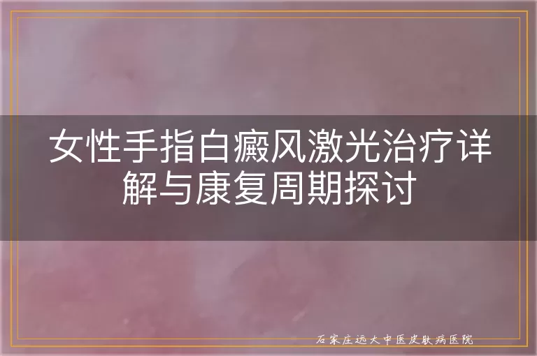 女性手指白癜风激光治疗详解与康复周期探讨