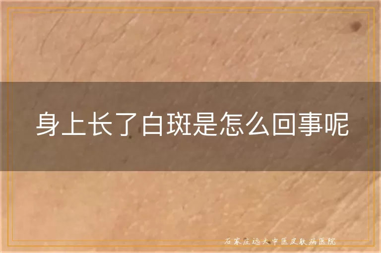 身上长了白斑是怎么回事呢