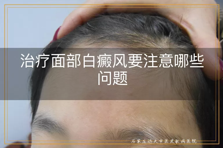 治疗面部白癜风要注意哪些问题