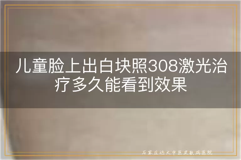 儿童脸上出白块照308激光治疗多久能看到效果