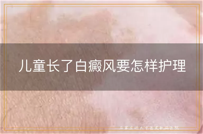 儿童长了白癜风要怎样护理