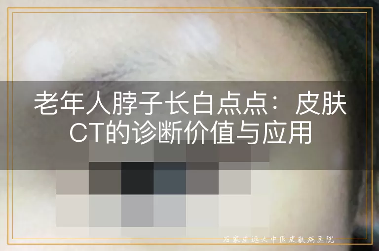 老年人脖子长白点点：皮肤CT的诊断价值与应用