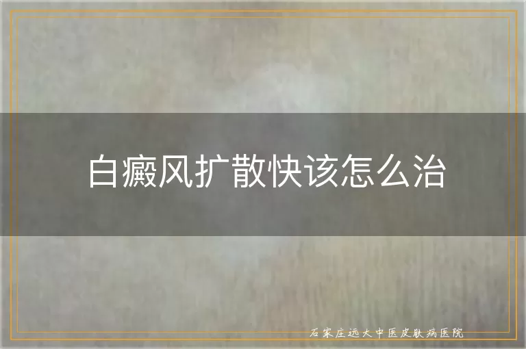 白癜风扩散快该怎么治