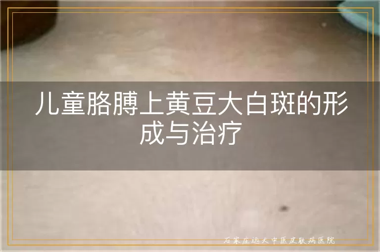 儿童胳膊上黄豆大白斑的形成与治疗