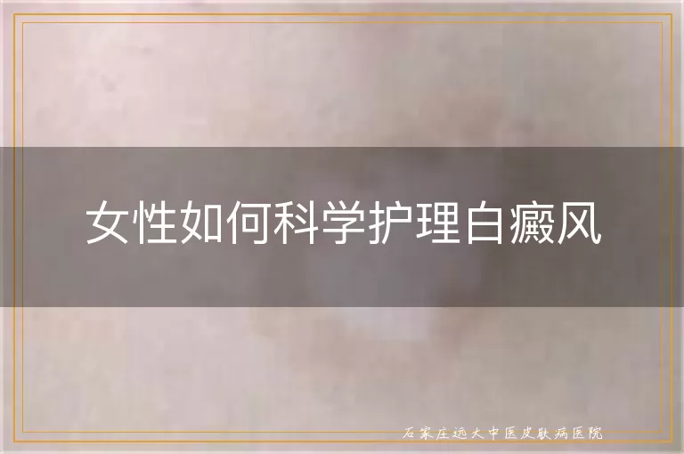 女性如何科学护理白癜风