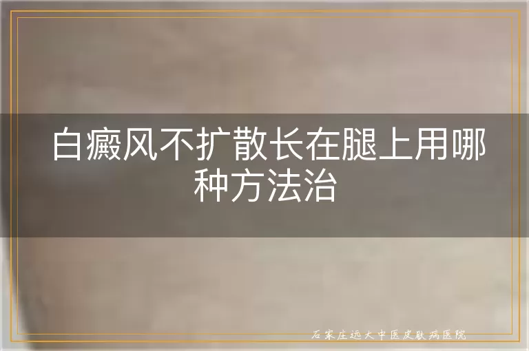 白癜风不扩散长在腿上用哪种方法治
