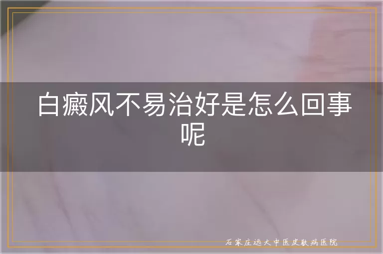 白癜风不易治好是怎么回事呢