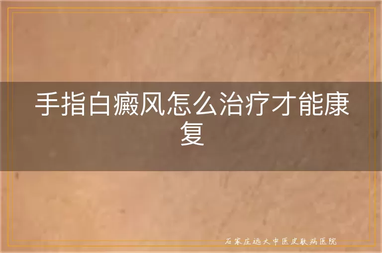 手指白癜风怎么治疗才能康复