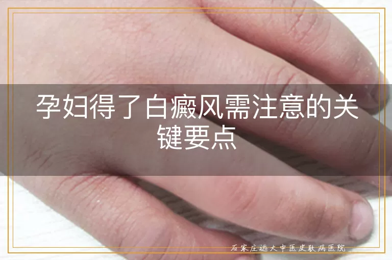孕妇得了白癜风需注意的关键要点