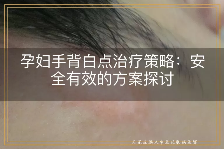 孕妇手背白点治疗策略：安全有效的方案探讨