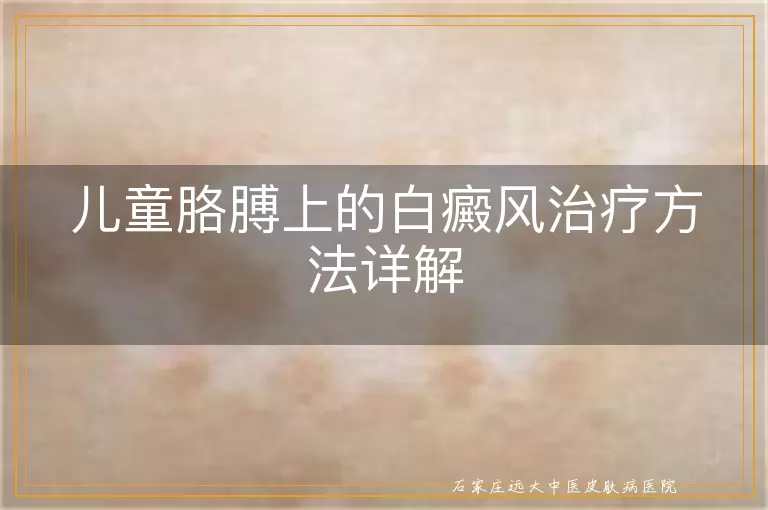 儿童胳膊上的白癜风治疗方法详解