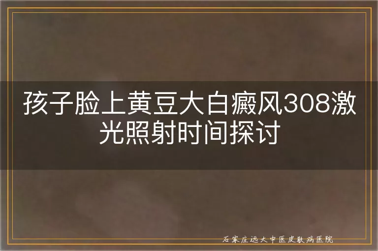 孩子脸上黄豆大白癜风308激光照射时间探讨