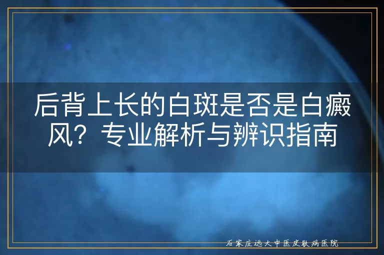 后背上长的白斑是否是白癜风？专业解析与辨识指南
