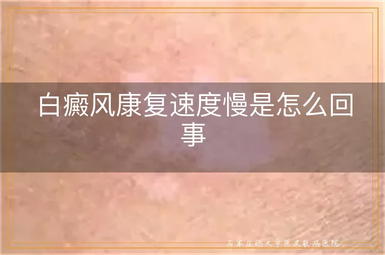 白癜风康复速度慢是怎么回事