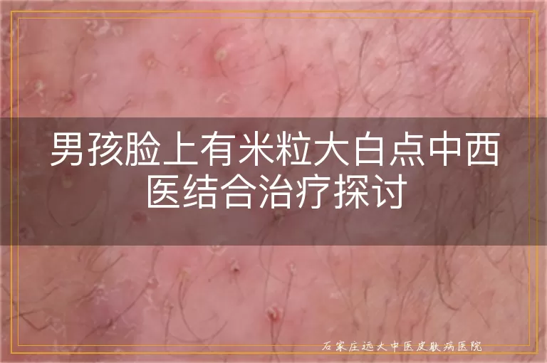 男孩脸上有米粒大白点中西医结合治疗探讨