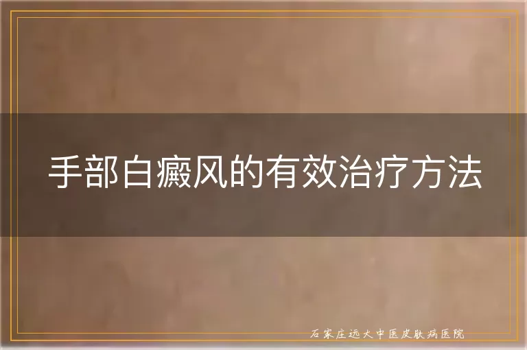 手部白癜风的有效治疗方法
