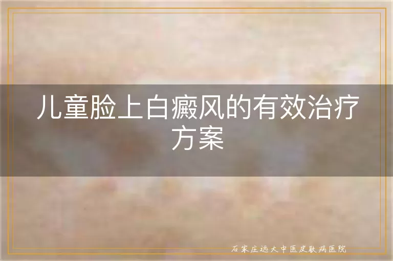 儿童脸上白癜风的有效治疗方案