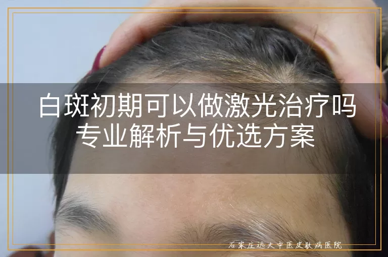 白斑初期可以做激光治疗吗专业解析与优选方案
