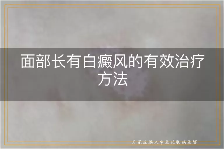 面部长有白癜风的有效治疗方法