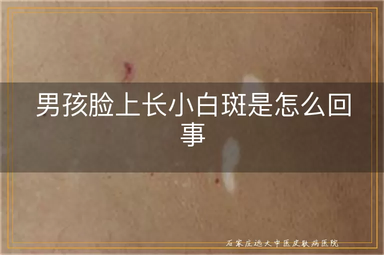 男孩脸上长小白斑是怎么回事