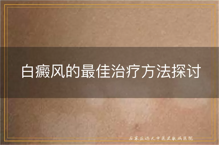 白癜风的最佳治疗方法探讨