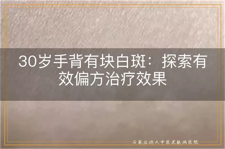 30岁手背有块白斑：探索有效偏方治疗效果