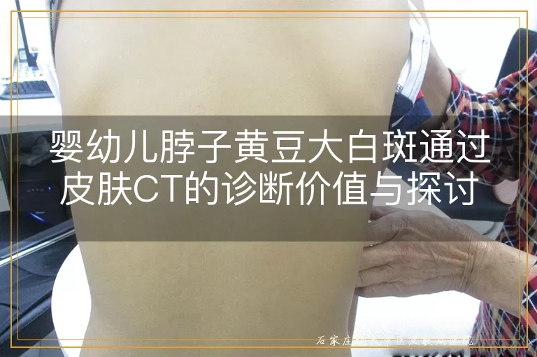 婴幼儿脖子黄豆大白斑通过皮肤CT的诊断价值与探讨