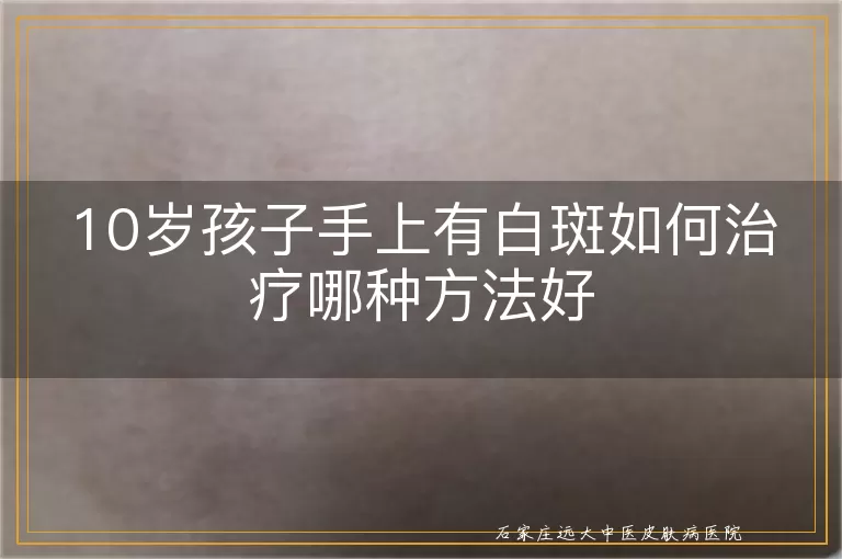 10岁孩子手上有白斑如何治疗哪种方法好